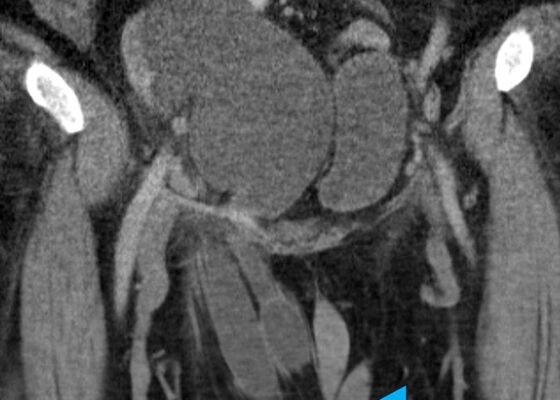 Creative Commons images