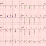 Creative Commons images