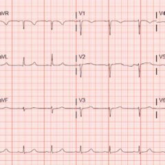 Creative Commons images