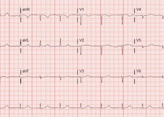 Creative Commons images