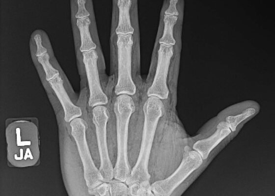 Creative Commons images