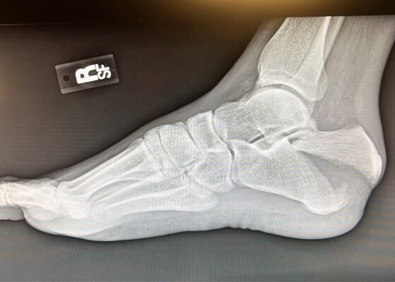 Creative Commons images