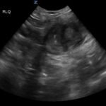 Creative Commons images