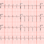 Creative Commons images