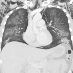 Creative Commons images