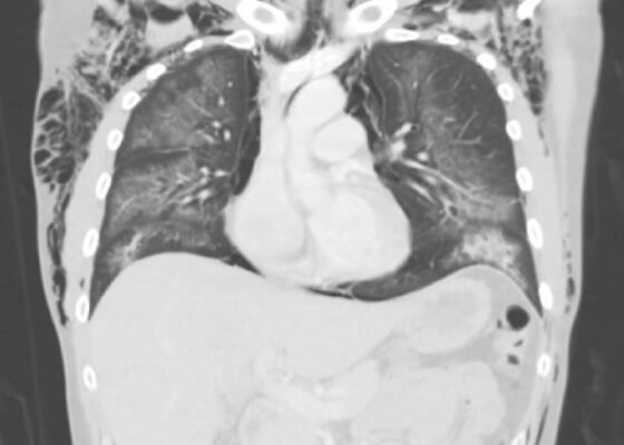 Creative Commons images