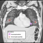 Creative Commons images