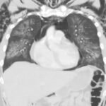 Creative Commons images