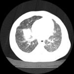 Creative Commons images