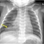 Creative Commons images