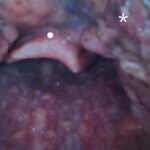 A Man with Sore Throat—A Case Report 2 Creative Commons images