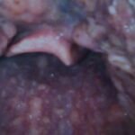 A Man with Sore Throat—A Case Report 1 Creative Commons images