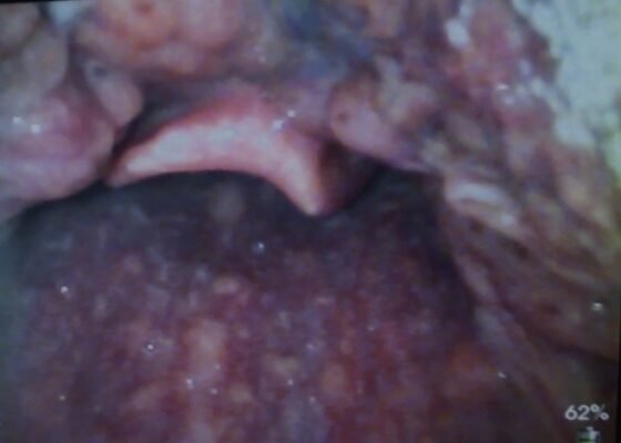 Creative Commons images