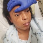 Mucormycosis. Photograph 1. JETem 2023
