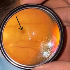 CRAO Exam. JETem 2023