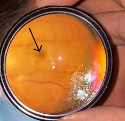 CRAO Exam. JETem 2023